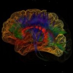 brain_connectivity-300x231