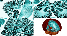 bigbrain_pic2