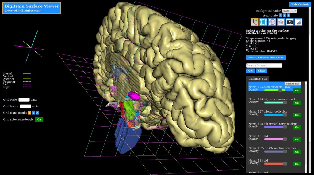 bigbrain_BrainBrowser