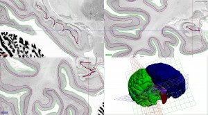 bigbrain_a3d_surf