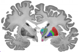 thalamus_4180_web_view